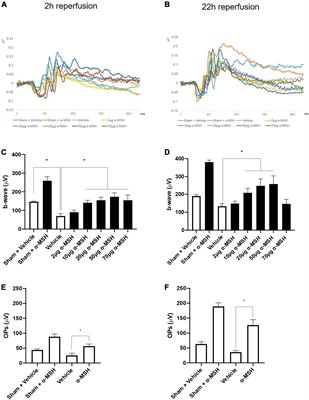 Anti-inflammatory α-Melanocyte-Stimulating Hormone Protects Retina After Ischemia/Reperfusion Injury in Type I Diabetes